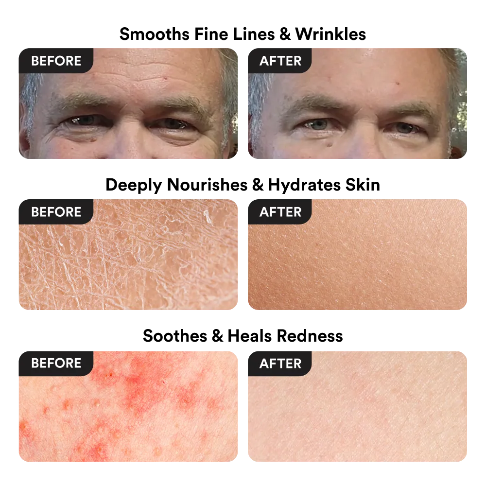 Nuveila Beef Tallow Balm® –  The only balm you will ever need