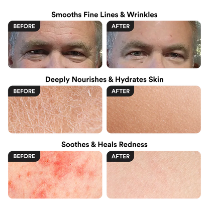 Nuveila Beef Tallow Balm® –  The only balm you will ever need